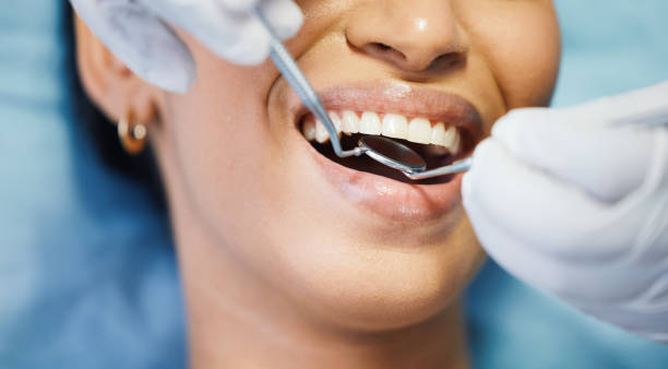 Best Emergency Dental Care for Broken or Chipped Teeth in Cedar Bluff, AL