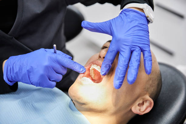 Best Emergency Treatment for Dental Infections or Abscesses in Cedar Bluff, AL